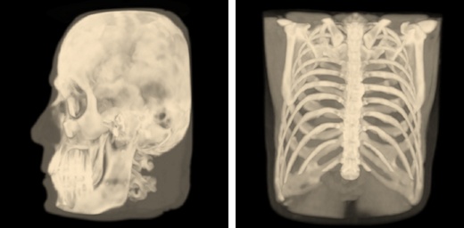 ../_images/mri-mip.jpg